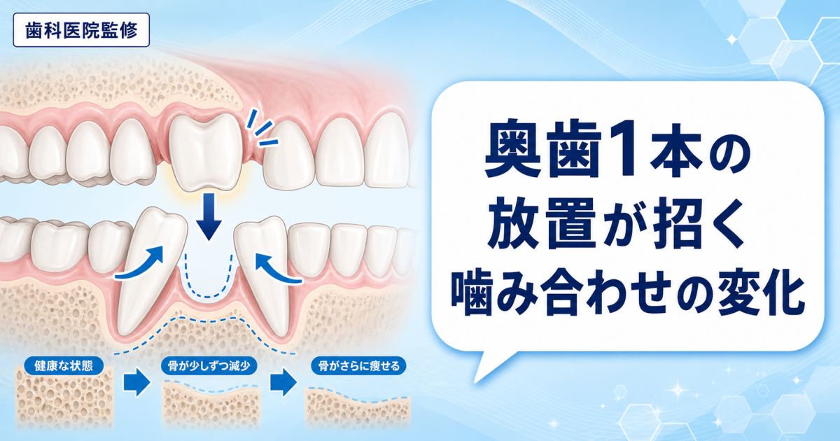 奥歯1本の放置は危険？噛み合わせ崩壊の連鎖と治療費増大リスク