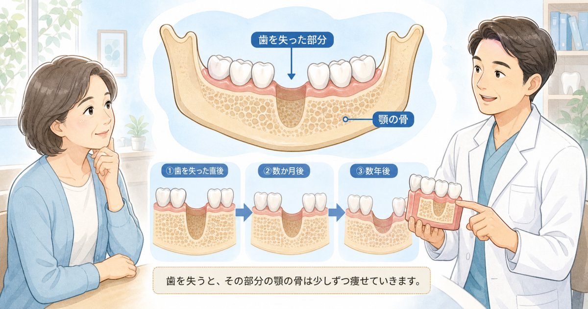 歯が抜けた後に骨が溶ける理由とは？放置のリスクと受診の目安